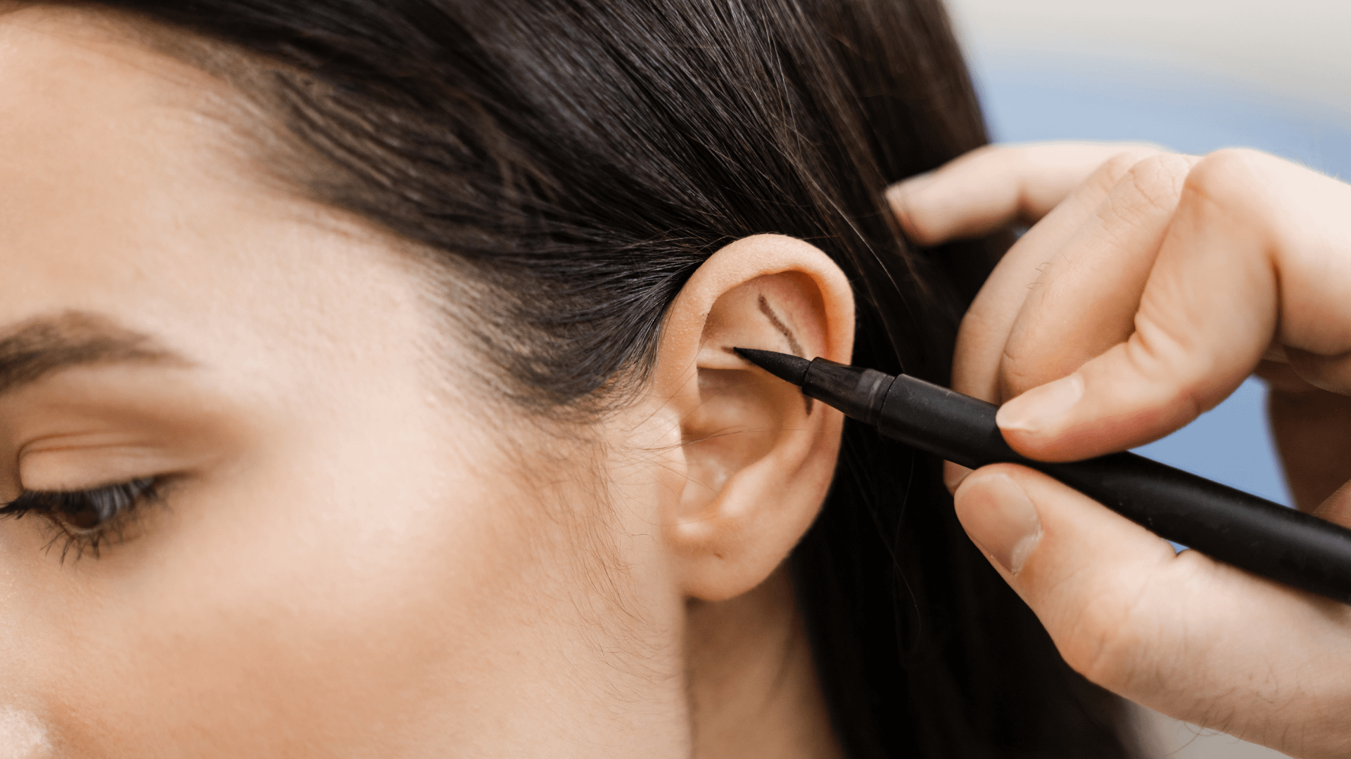 Otoplastie oreilles decollees Geneve Dr Thomet